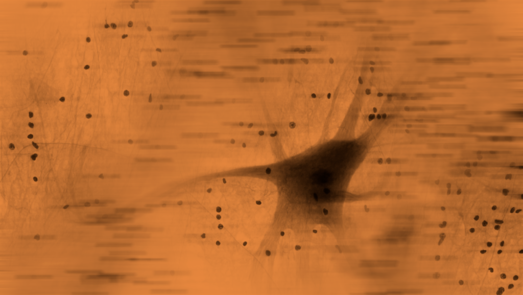 Abstract orange background with blurred dark specks and central black network-like shape.