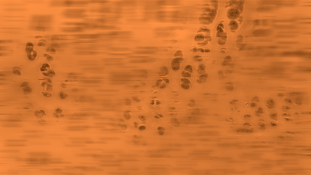 Microscopic view of cell-like structures on orange background with scattered oval shapes.