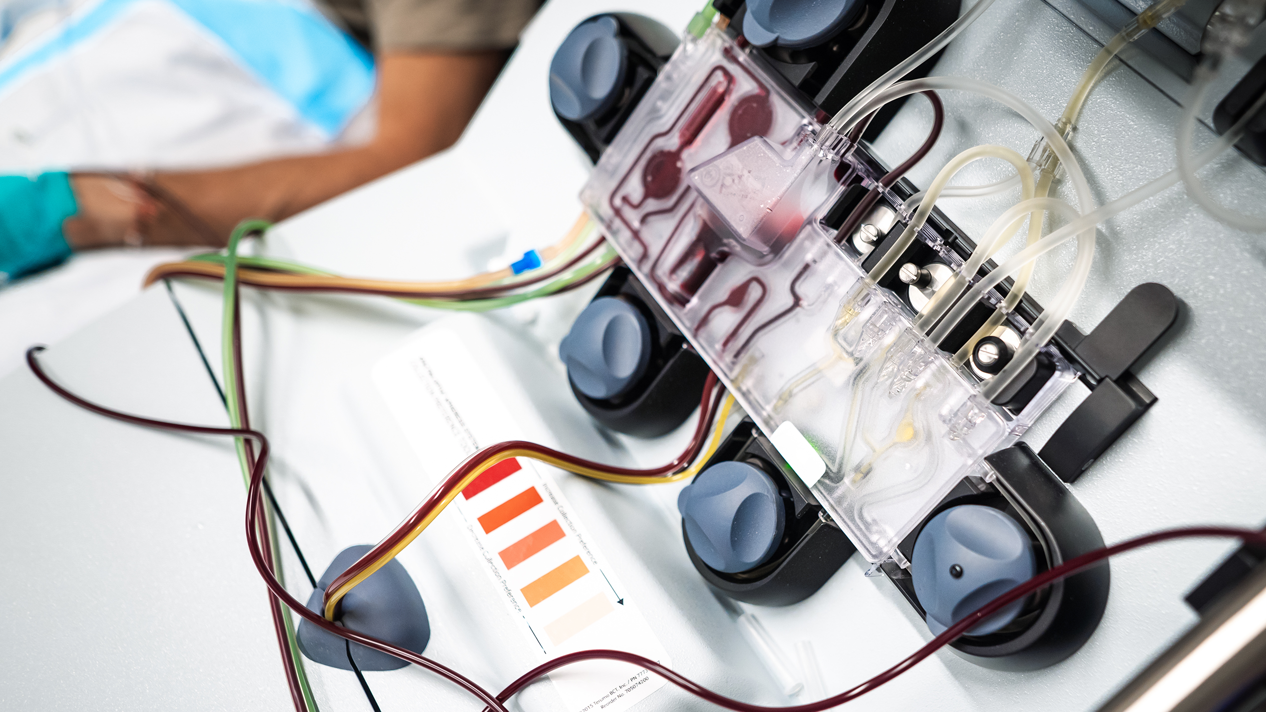 Dialysis machine with tubes showing blood flow connected to a patient’s arm.