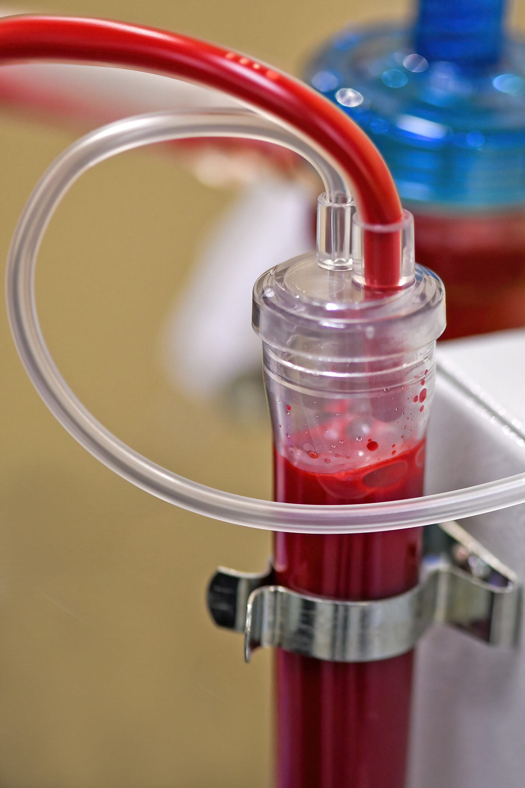 Close-up of medical tubing and a container with red fluid, secured by a metal clamp.